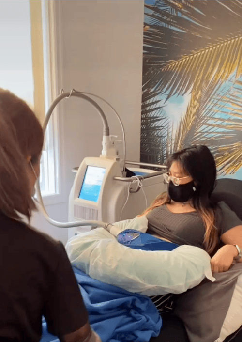 Coolsculpt Treatment | Newport Beach, CA, | The Beauty Hut Face & Body Sculpting