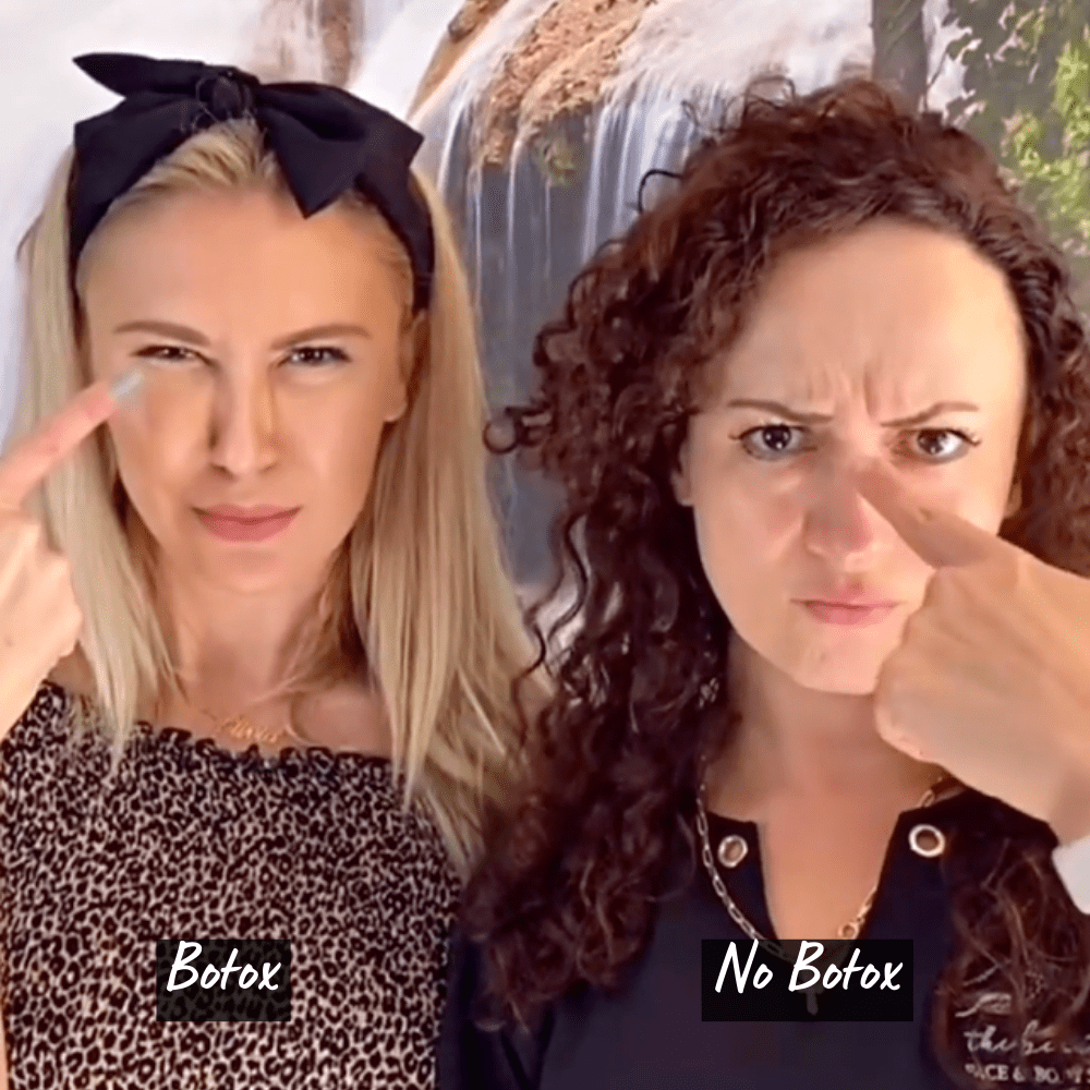 Botox Treatment Before & After Photos | Newport Beach, CA, | The Beauty Hut Face & Body Sculpting