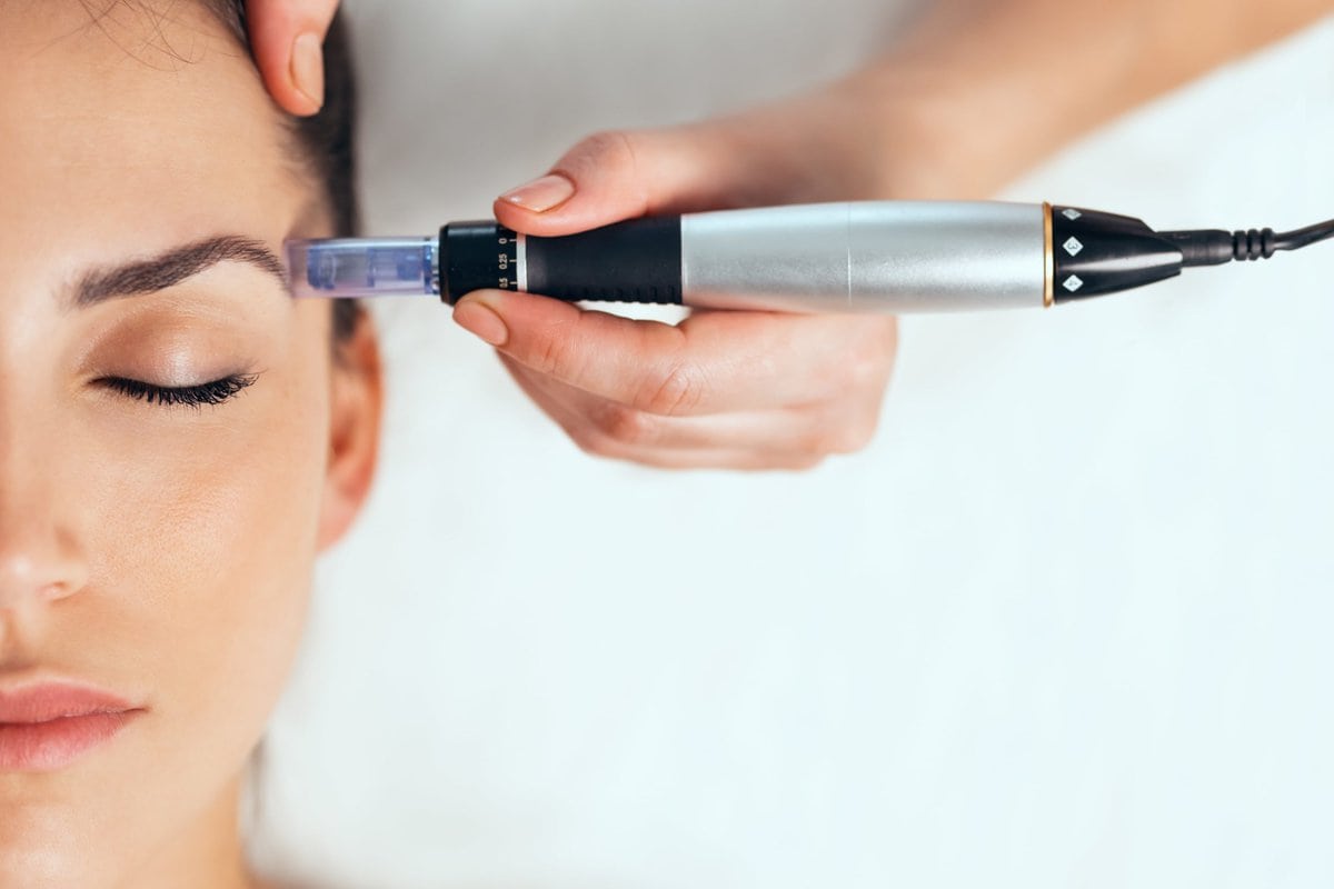 SkinPen Microneedling The Key to a Youthful Glow and Healthy Skin