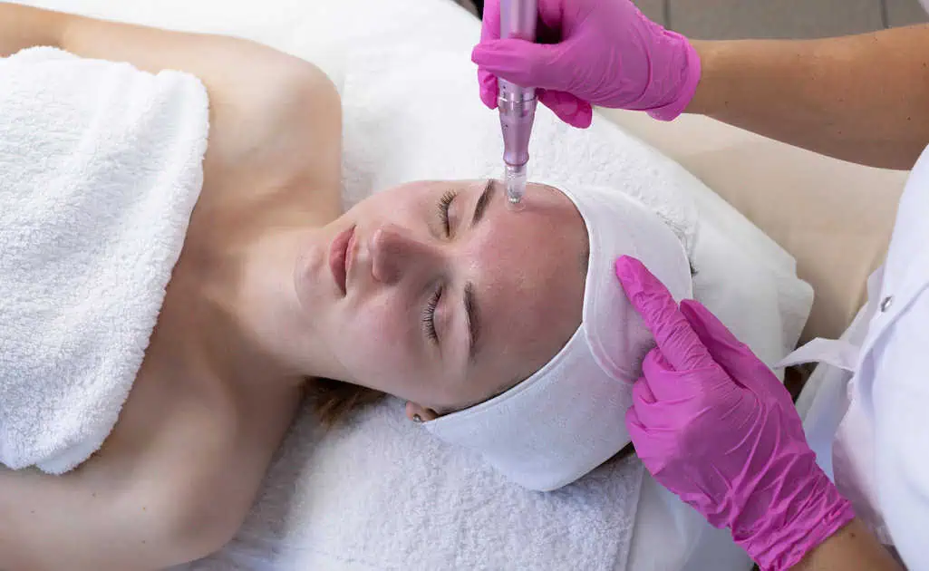 Pixel-8 RF Microneedling by The Beauty Hut LLC in Newport Beach, CA