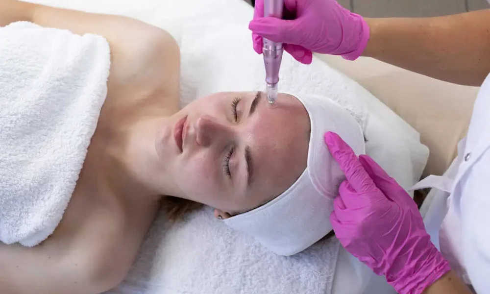 Pixel-8 RF Microneedling by The Beauty Hut LLC in Newport Beach, CA